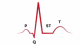 ECG Made Easy: Video Lectures (Copy 1)