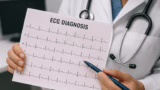 ECG DIAGNOSIS : A to Z